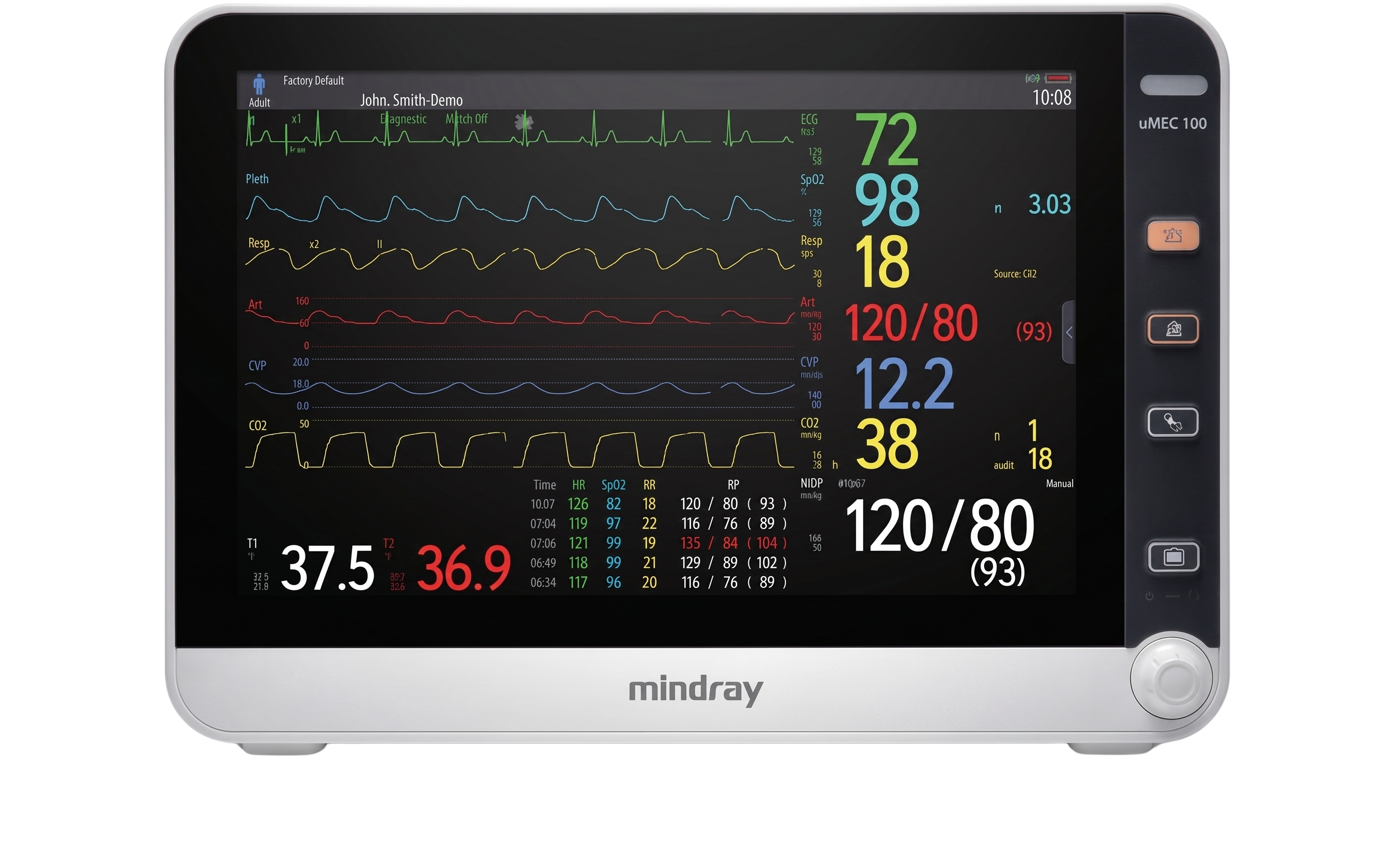 Mindray uMEC 100/150