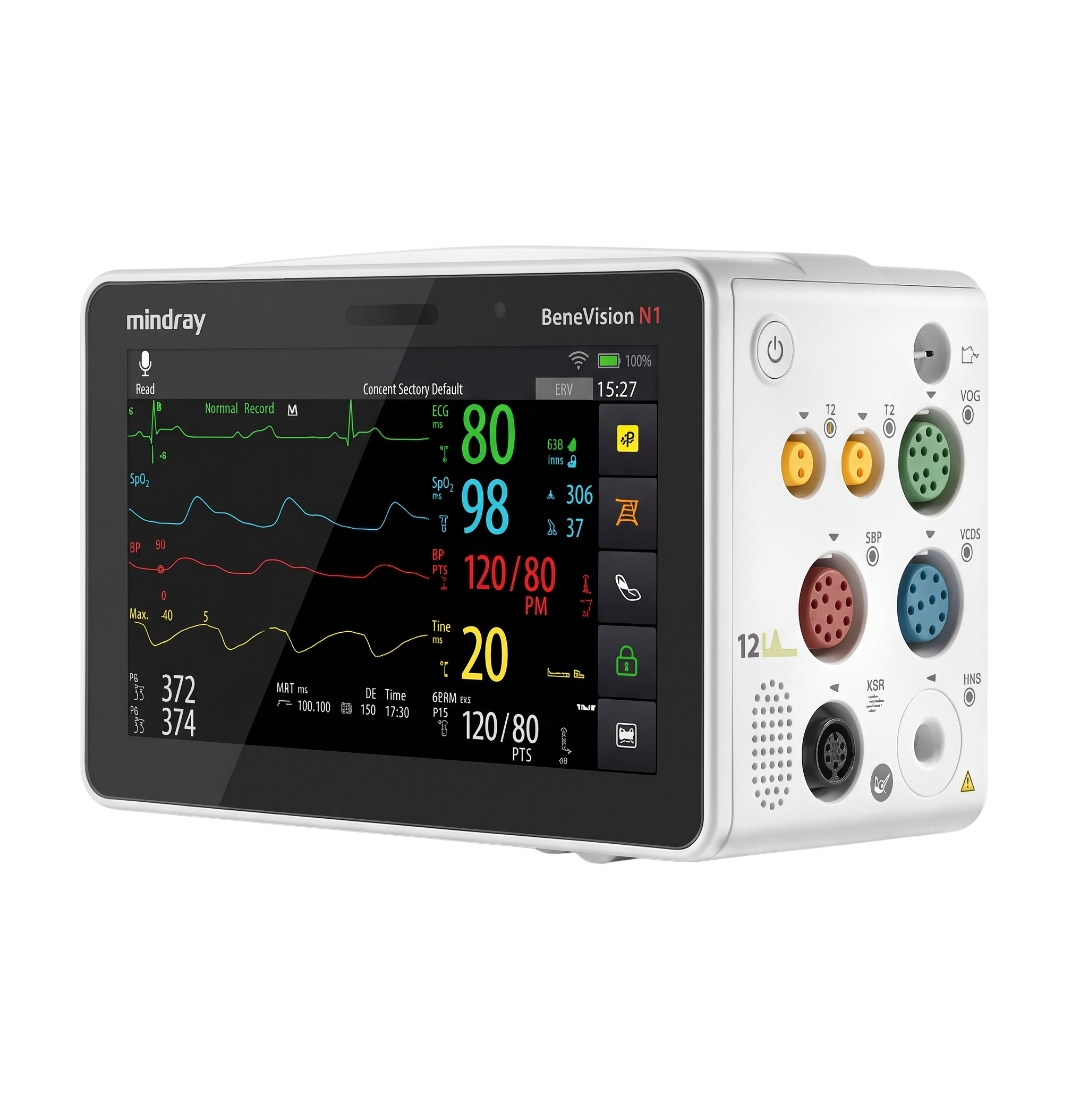 Mindray BeneVision N1